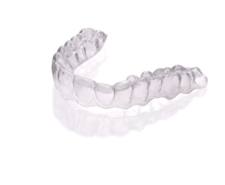 clear aligner